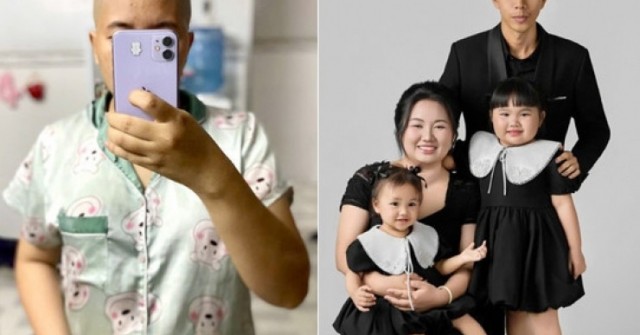 Vợ cạo trọc đầu vì trầm cảm, chồng làm điều xúc động, dìu qua biến cố