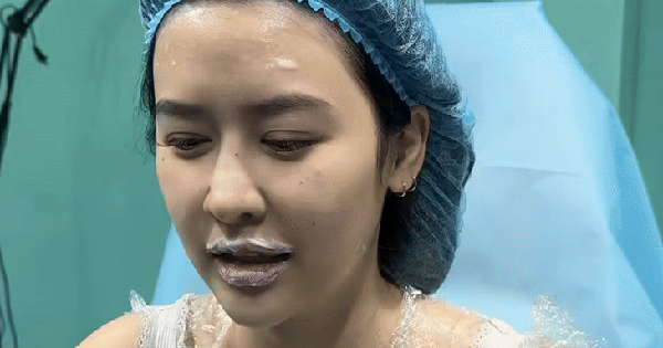 Quyên Qui tu sửa gương mặt