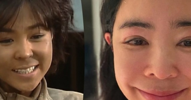 'Nàng Quạ' Lee Hye Young mắt sưng húp sau điều trị ung thư