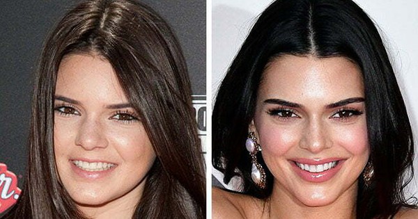 Kendall Jenner mà đẹp tự nhiên sao?