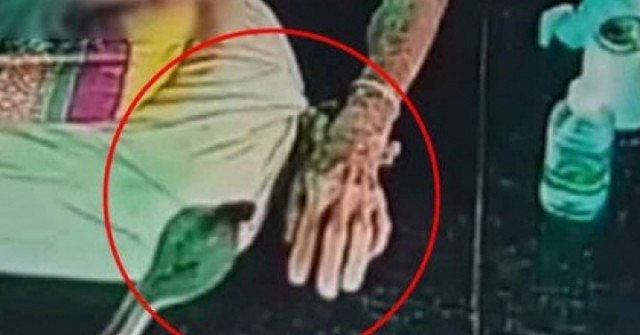 Đang nằm trên giường, cụ bà 93 tuổi bất ngờ bị rắn hổ mang cắn vào tay