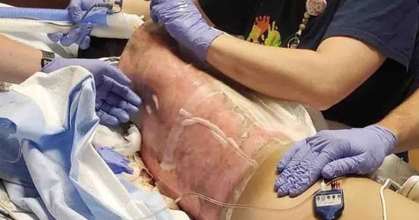 5 thử thách TikTok cực nguy hiểm, có một thử thách từng giết chết hơn 100 người