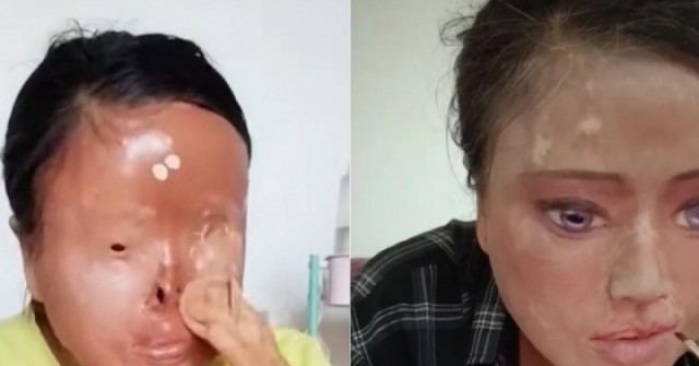 Người phụ nữ tự vẽ mắt, gắn mũi sau bi kịch bị chồng cũ tạt axit
