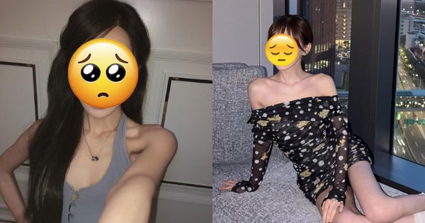 Phát hoảng thân hình 