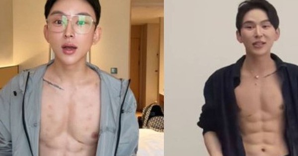 Hot boy chi 14,8 tỷ đồng tiêm axit tạo cơ bụng 8 múi, chuyên gia sợ hãi cảnh báo