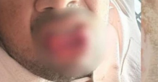 Bị quấy rối trên đường, cô gái đáp trả theo cách khiến kẻ tấn công choáng váng