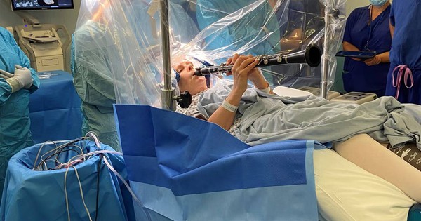 Người phụ nữ thổi kèn trong suốt ca phẫu thuật não kéo dài 4 tiếng