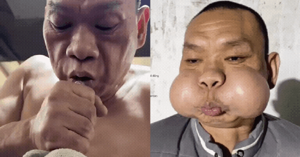 Nỗi khổ của “hoàng tử ếch”