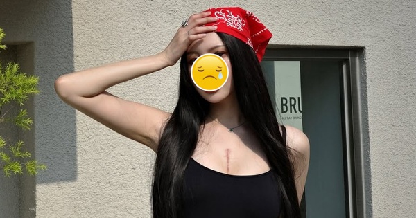 Nữ thần sắc đẹp 29 tuổi qua đời vào sáng nay vì mắc bệnh hiếm gặp