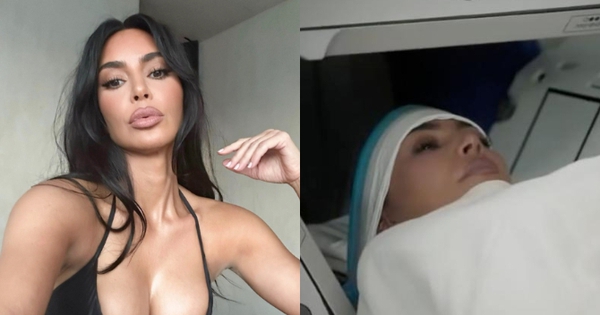 “Kim siêu vòng 3” bị phình mạch máu não