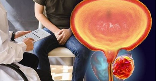 Giới khoa học tìm ra cách kìm hãm một trong những căn bệnh ung thư nguy hiểm nhất
