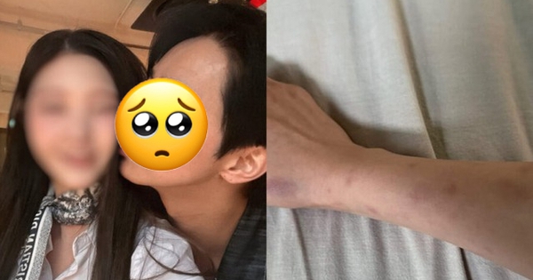 Công bố kết quả điều tra vụ nam diễn viên ngoan hiền bị tố đánh đập, “đào mỏ” bạn gái hàng trăm triệu