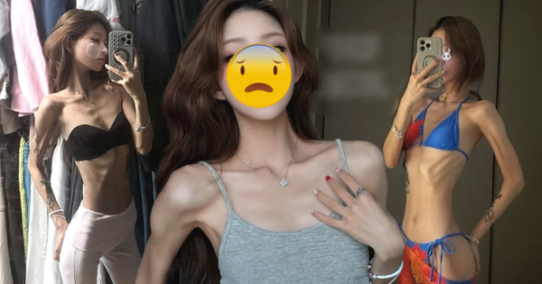 Phát sợ với cơ thể gầy trơ xương, héo mòn của con gái 